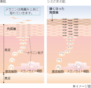 いつの間にか増えているシミ